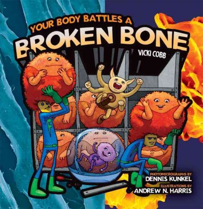 Your body battles a broken bone / by Vicki Cobb ; with microphotographs by Dennis Kunkel ; illustrated by Andrew N. Harris.
